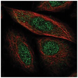 SCP2/SYCP2 Antibody, Novus Biologicals:Antibodies:Primary Antibodies