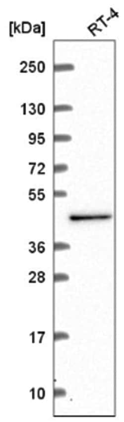 SDCCAG10 Antibody, Novus Biologicals 25 &mu;L, Unlabeled:Antibodies, Polyclonal