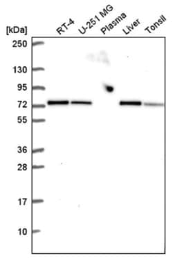 SDHA Antibody, Novus Biologicals 100&mu;L; Unlabeled:Antibodies, Polyclonal