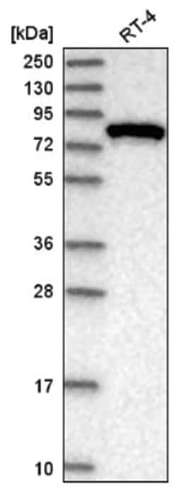 SEC6 Antibody, Novus Biologicals 100&mu;L; Unlabeled:Antibodies, Polyclonal