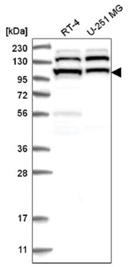 Sec8 Antibody, Novus Biologicals 25 &mu;L:Antibodies, Polyclonal