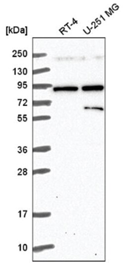 Semaphorin 3A Antibody, Novus Biologicals:Antibodies:Primary Antibodies
