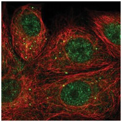 Semaphorin 3E Antibody, Novus Biologicals 100&mu;L; Unlabeled:Antibodies,