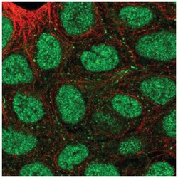 Semaphorin 4A Antibody, Novus Biologicals:Antibodies:Primary Antibodies