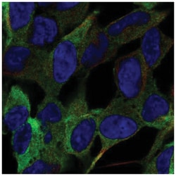 Semaphorin 5B Antibody, Novus Biologicals:Antibodies:Primary Antibodies