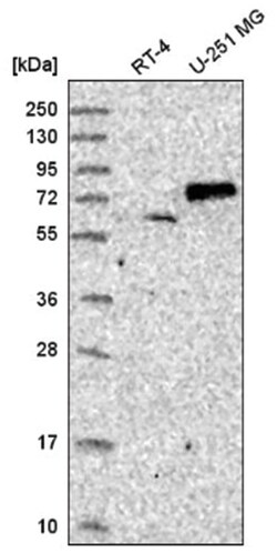 SENP1 Antibody, Novus Biologicals 25 &mu;L; Unconjugated:Antibodies, Polyclonal