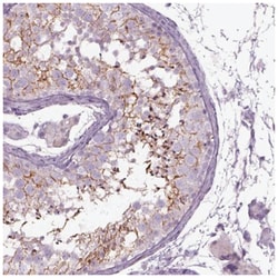 Septin-14 Antibody, Novus Biologicals 100&mu;L; Unlabeled:Antibodies, Polyclonal