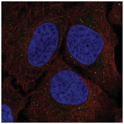 Serine racemase Antibody, Novus Biologicals:Antibodies:Primary Antibodies