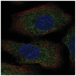 Serotonin N-acetyltransferase Antibody, Novus Biologicals 25 &mu;L:Antibodies,
