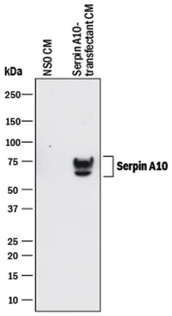 Human Serpin A10/ZPI Antibody, R D Systems 25&mu;g; Unlabeled:Antibodies,