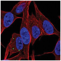 SERTM1 Antibody, Novus Biologicals 25 &mu;L, Unlabeled:Antibodies, Polyclonal