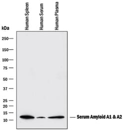 Human Serum Amyloid A1/A2 Antibody, R D Systems:Antibodies:Primary Antibodies