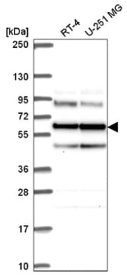 Seryl tRNA synthetase Antibody, Novus Biologicals 25 &mu;L:Antibodies,