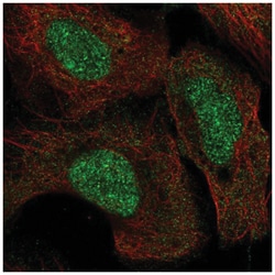 SETD8 Antibody, Novus Biologicals:Antibodies:Primary Antibodies