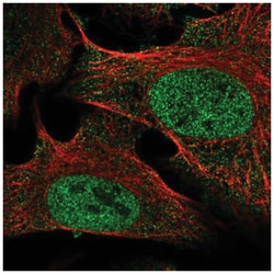SETDB2 Antibody, Novus Biologicals:Antibodies:Primary Antibodies