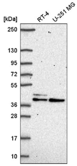 SETMAR Antibody, Novus Biologicals 25 &mu;L, Unlabeled:Antibodies, Polyclonal