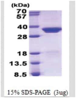 Novus Biologicals&trade;&nbsp;Recombinant Human SF2 His Protein