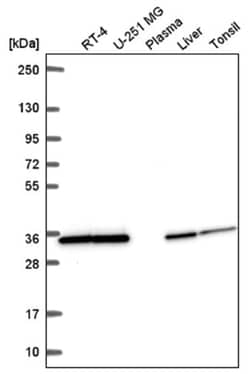SFXN1 Antibody, Novus Biologicals:Antibodies:Primary Antibodies