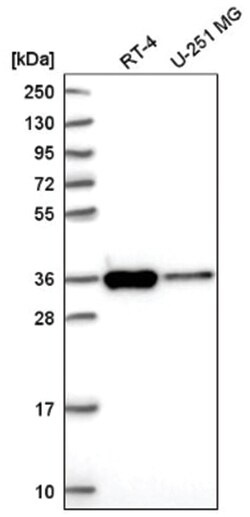 SFXN3 Antibody, Novus Biologicals 100&mu;L; Unlabeled:Antibodies, Polyclonal