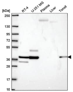 epsilon-Sarcoglycan Antibody, Novus Biologicals 25 &mu;L, Unlabeled:Antibodies,