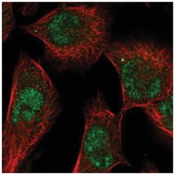 SGK1 Antibody, Novus Biologicals:Antibodies:Primary Antibodies