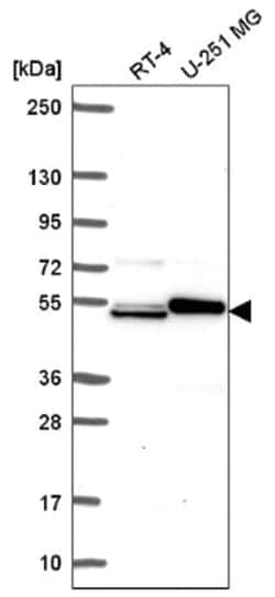 SH2D3A Antibody, Novus Biologicals 25 &mu;L, Unlabeled:Antibodies, Polyclonal