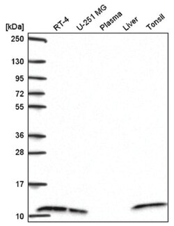 SH3BGRL3 Antibody, Novus Biologicals 25 &mu;L, Unlabeled:Antibodies, Polyclonal
