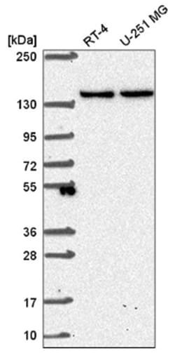 SH3TC1 Antibody, Novus Biologicals 100&mu;L; Unlabeled:Antibodies, Polyclonal