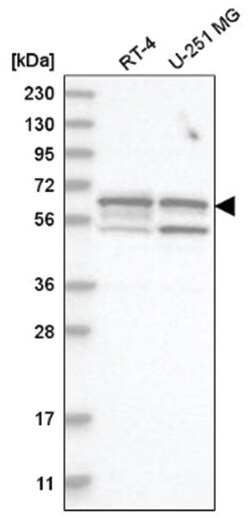 SHC3 Antibody, Novus Biologicals 25 &mu;L, Unlabeled:Antibodies, Polyclonal