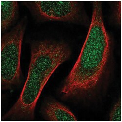 SHF Antibody, Novus Biologicals 100&mu;L; Unlabeled:Antibodies, Polyclonal