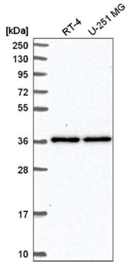 SHISA2 Antibody, Novus Biologicals 100&mu;L; Unlabeled:Antibodies, Polyclonal