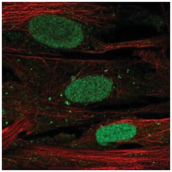 SHOX Antibody, Novus Biologicals:Antibodies:Primary Antibodies