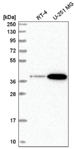 Signal peptide peptidase-like 2B Antibody, Novus Biologicals 100&mu;L;