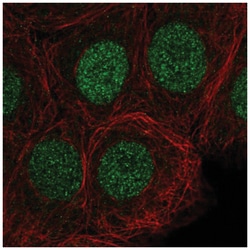 SIRT6 Antibody, Novus Biologicals:Antibodies:Primary Antibodies