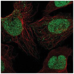 Sirtuin 1/SIRT1 Antibody, Novus Biologicals 25 &mu;L | Buy Online | Novus Biologicals | Fisher Scientific