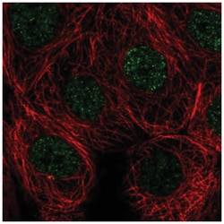 SIVA Antibody, Novus Biologicals:Antibodies:Primary Antibodies