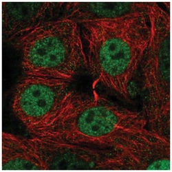SIVA Antibody, Novus Biologicals 100&mu;L; Unlabeled:Antibodies, Polyclonal