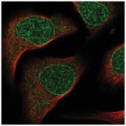 SIX2 Antibody, Novus Biologicals 100&mu;L; Unlabeled:Antibodies, Polyclonal