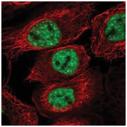 SKAR Antibody, Novus Biologicals 100&mu;L; Unlabeled:Antibodies, Polyclonal