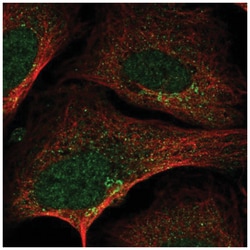 SLA2 Antibody, Novus Biologicals:Antibodies:Primary Antibodies