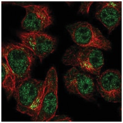 SLA2 Antibody, Novus Biologicals 100&mu;L; Unlabeled:Antibodies, Polyclonal