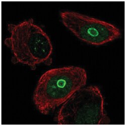 SLC10A7 Antibody, Novus Biologicals 25 &mu;L, Unlabeled:Antibodies, Polyclonal
