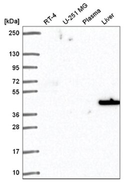 SLC14A1 Antibody, Novus Biologicals 100 &mu;L | Buy Online | Novus Biologicals | Fisher Scientific
