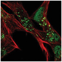 SLC16A6 Antibody, Novus Biologicals:Antibodies:Primary Antibodies