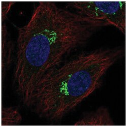 SLC17A1/NPT Antibody, Novus Biologicals 25 &mu;L:Antibodies, Polyclonal