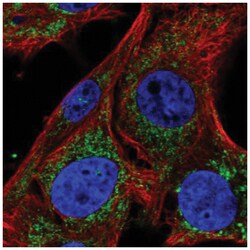 SLC25A34 Antibody, Novus Biologicals 100&mu;L; Unlabeled:Antibodies, Polyclonal