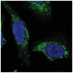 SLC25A44 Antibody, Novus Biologicals:Antibodies:Primary Antibodies