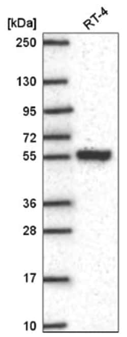 SLC25A46 Antibody, Novus Biologicals 100&mu;L; Unlabeled:Antibodies, Polyclonal
