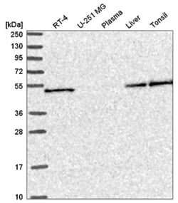 SLC25A46 Antibody, Novus Biologicals 25 &mu;L, Unlabeled:Antibodies, Polyclonal