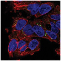 SLC29A3 Antibody, Novus Biologicals:Antibodies:Primary Antibodies